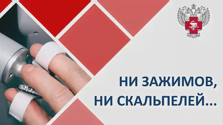 Робот хирург. 🌟 Новые медицинские технологии робот хирург, лечение рака ультразвуком, реабилитация