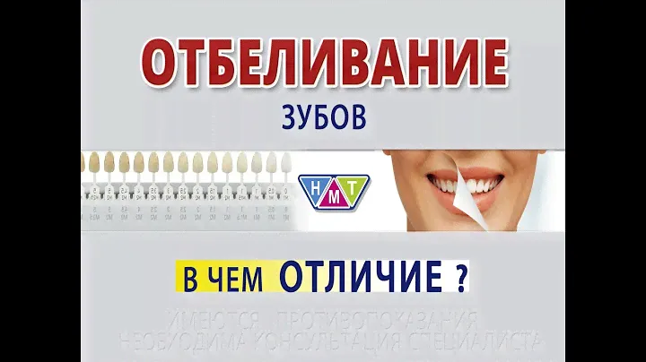 ОТБЕЛИВАНИЕ зубов. Что надо знать?