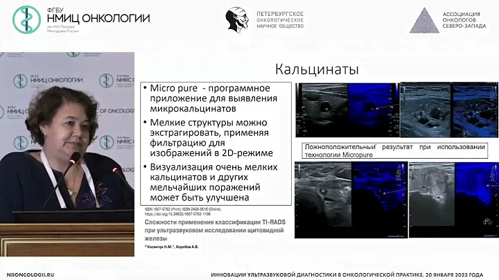 Современные тенденции УЗ - диагностики очаговых образований щитовидный железы